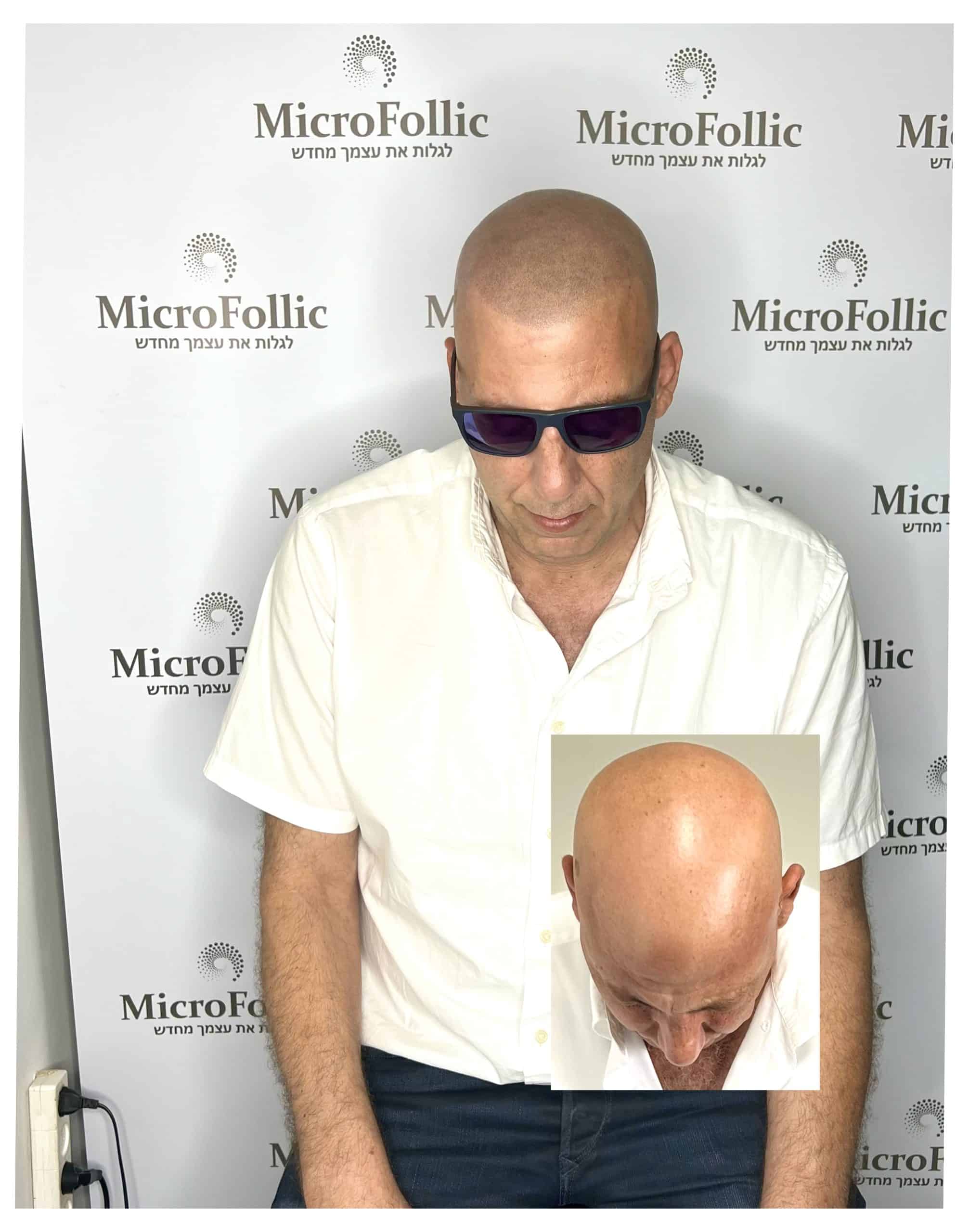 הדמיית שיער תחזוקה