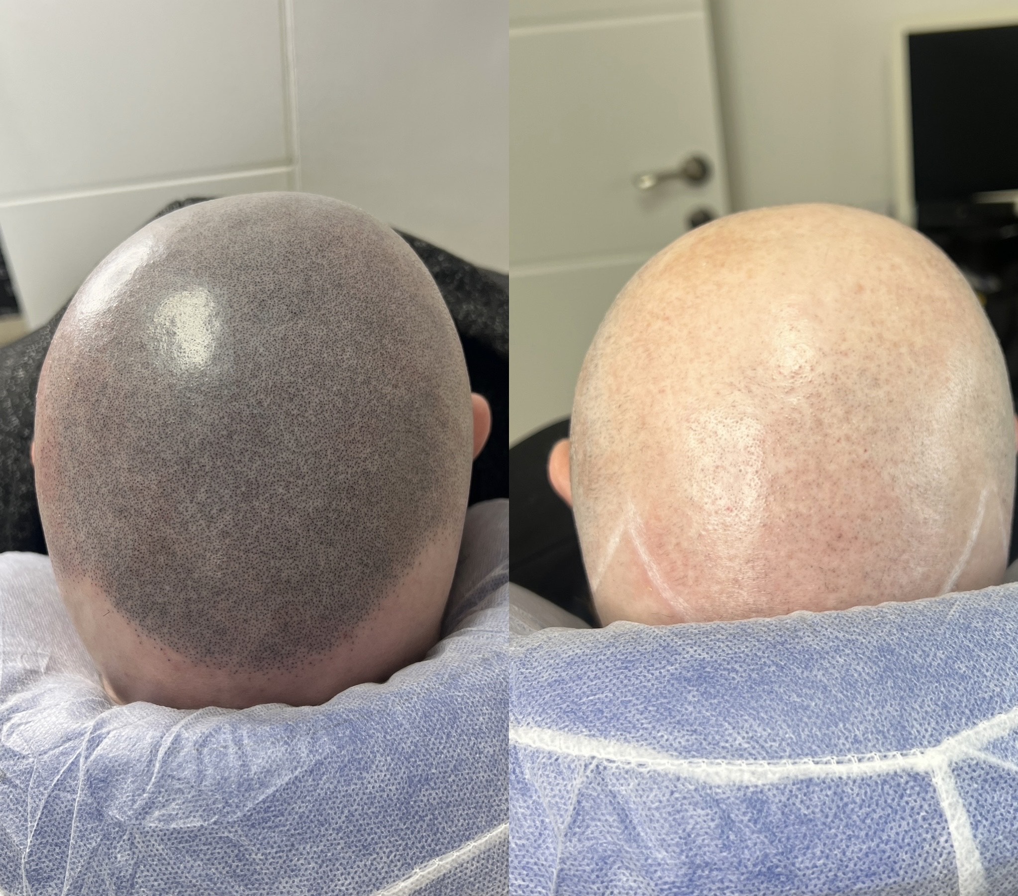 טיפול אסתטי עם תוצאה טבעית