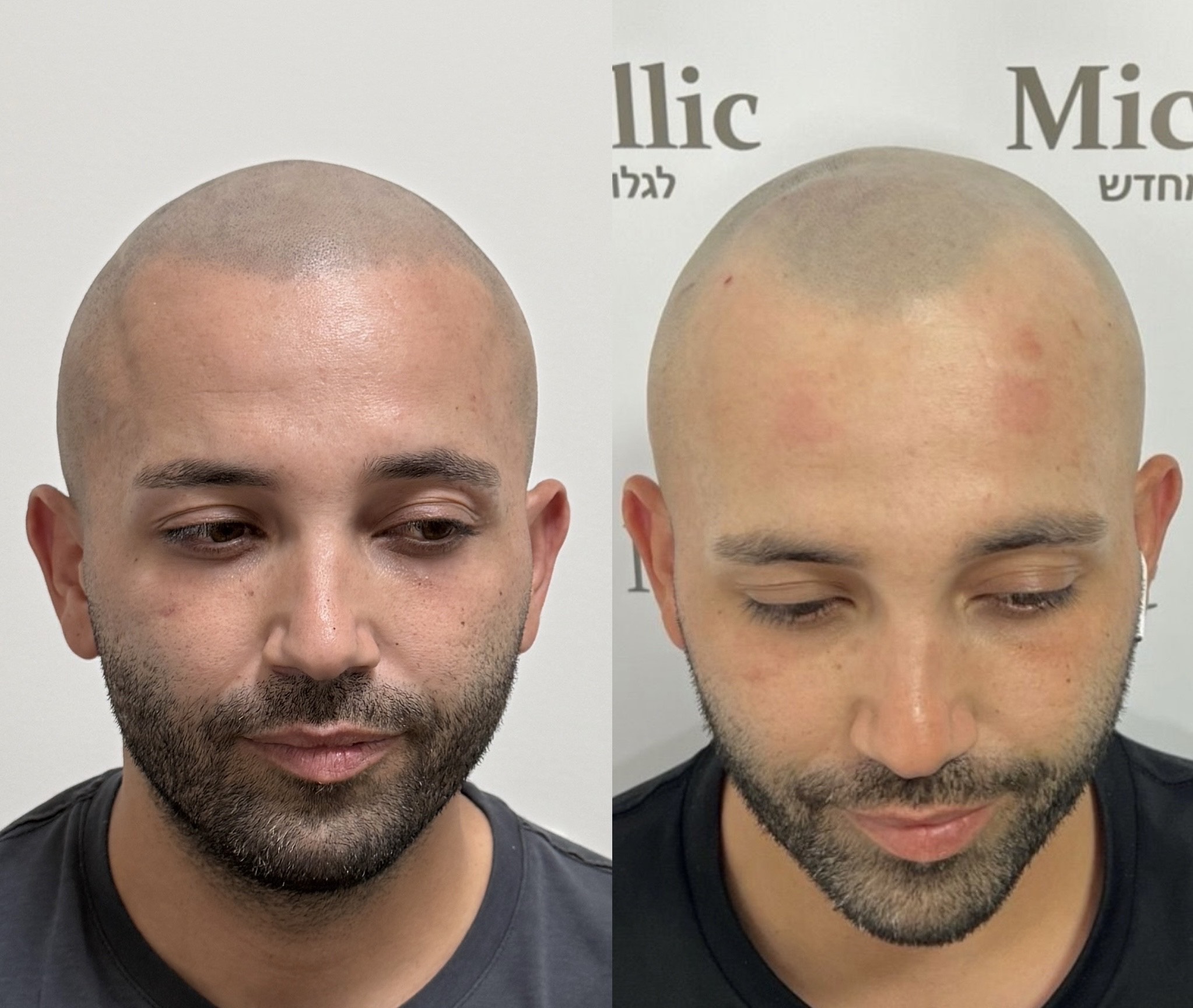 יצירת מראה טבעי ומדויק