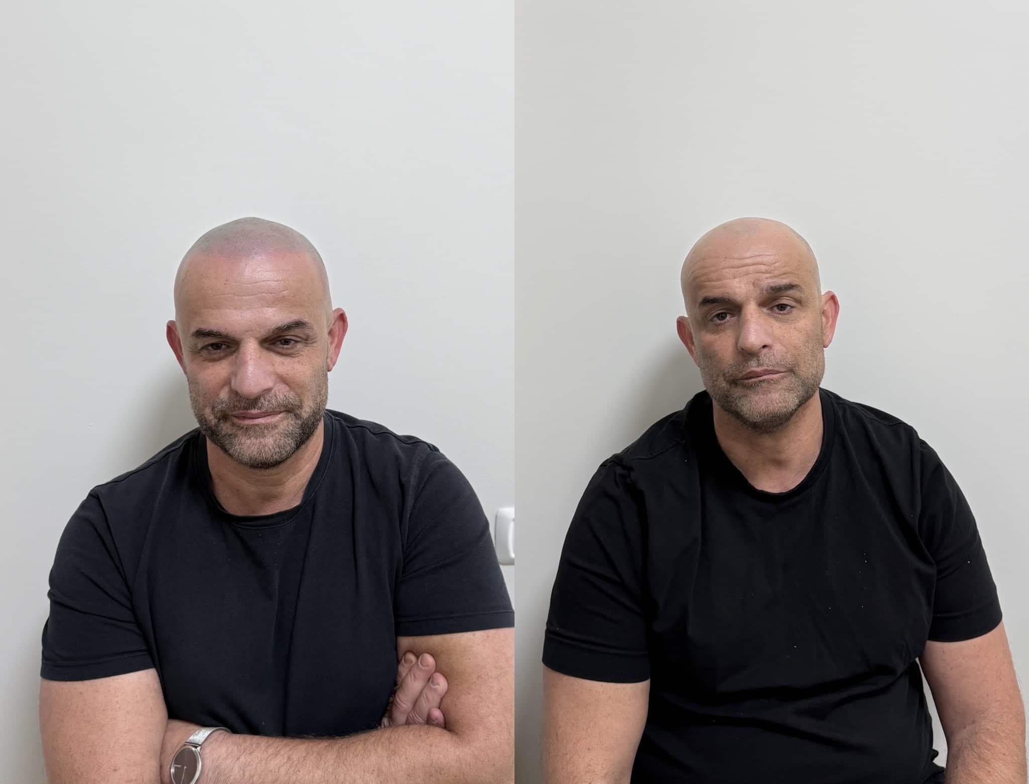 שיפור תוצאה קיימת בדיוק מקצועי